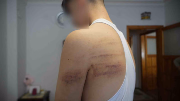 Çırağını Darp Eden Berber Tutuklandı