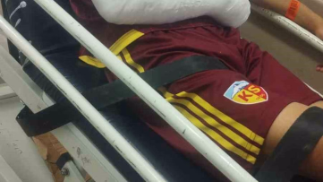 Kayserisporlu Hilmi Türkan Sakatlandı