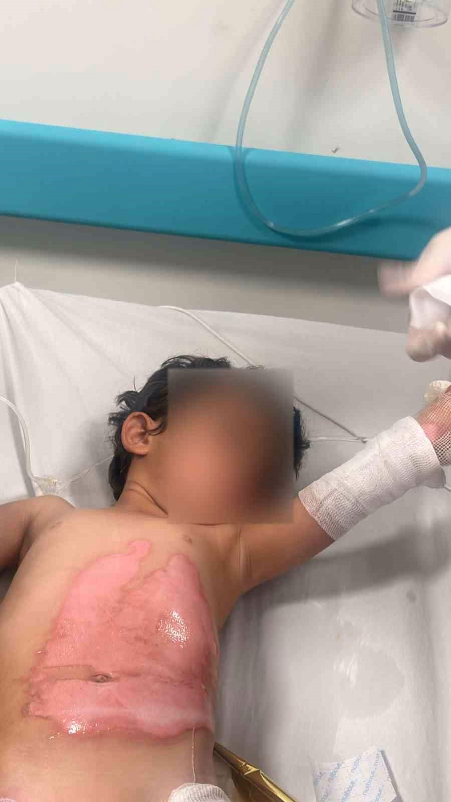 Şırnak'ta kaynar su dökülen çocuk yaralandı